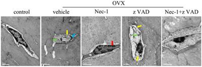 Comparison of Necroptosis With Apoptosis for OVX-Induced Osteoporosis